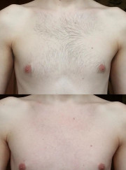 Мастер эпиляции Наталья Владимировна Смирнова