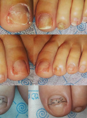 Подолог Анна Владимировна Ничутина