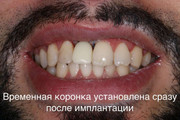 сертификат/документ Стоматологической клиники Лаки Смайл
