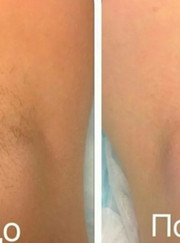 Мастер эпиляции, парикмахер Ася Алисултановна Курбанова