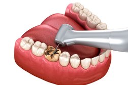 Стоматология Доктор Дент, с рейтингом 4.5 - находится по адресу Республика Марий Эл, Йошкар-Ола, улица Кирова, 11в 