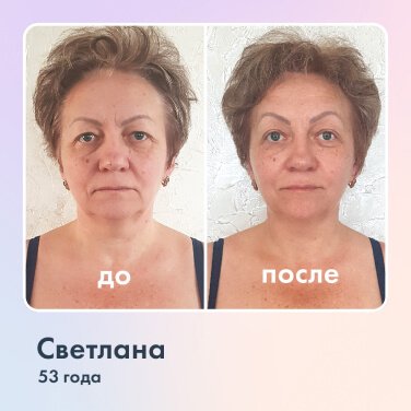 фотография Школы естественного омоложения Revitonica