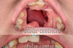 Национальный медицинский исследовательский центр оториноларингологии Федерального медико-биологического агентства Хабаровский филиал, с рейтингом 3.8 - находится по адресу Хабаровск, Краснодарская улица, 9 